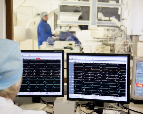 cardiovascular-heart